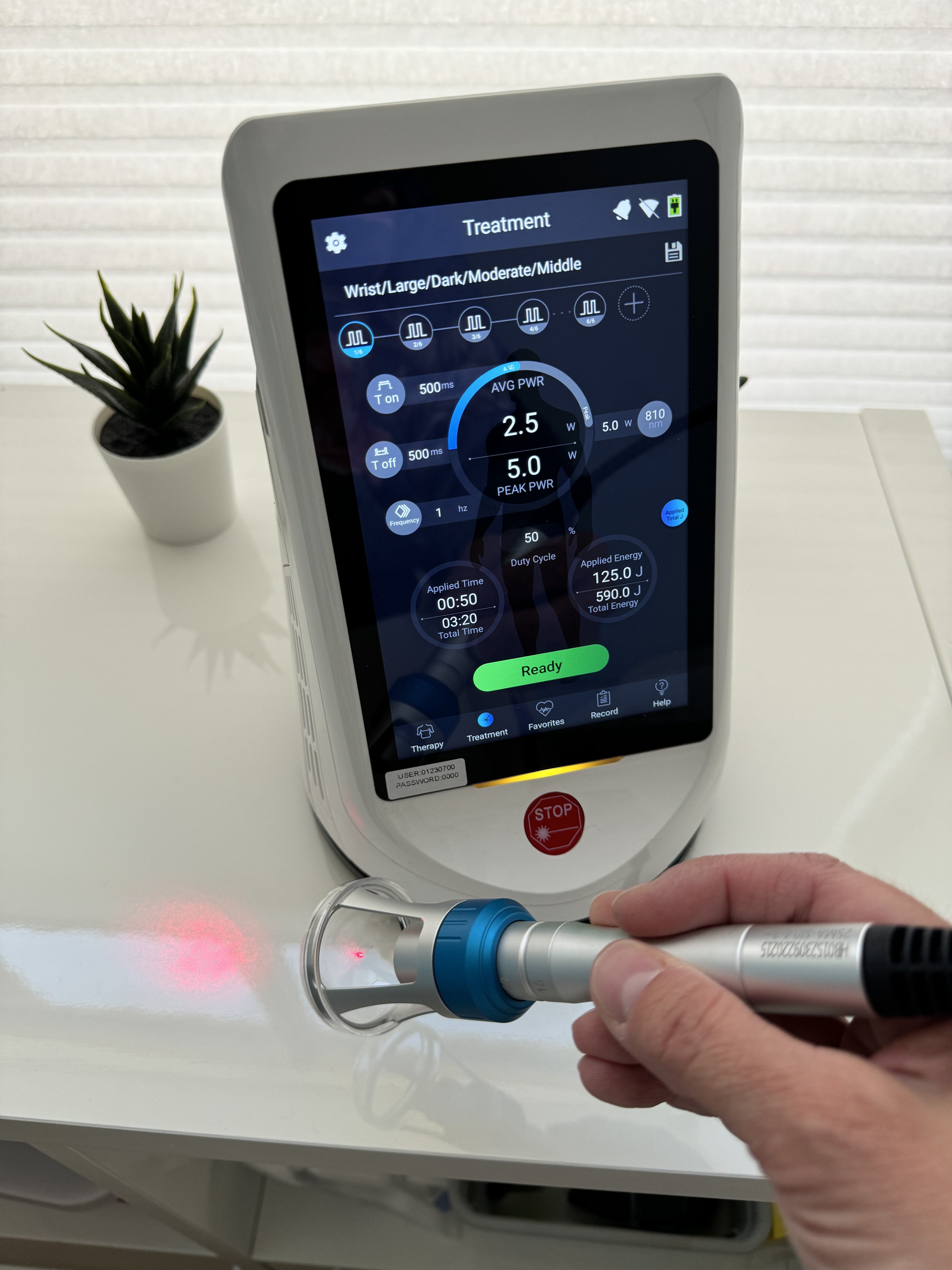 Cold Laser Therapy machine treatment screen turned on with the handheld laser also on, showing a red light pointed at a white marble surface